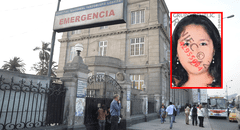 Muere el hombre que fue quemado vivo por su expareja en La Libertad
