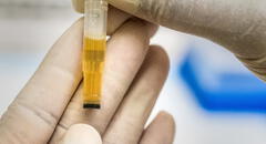 ¿Qué significa el color de la orina y en qué casos representa una infección?