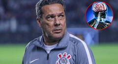 Emergencia por Guillain Barré en Perú preocupa a DT de Corinthians: "No somos conejillos de indias"