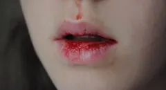 ¿Qué significa soñar con sangre que sale de la boca de otra persona?