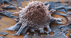 Científicos logran convertir tumores cancerosos en células sanas con tecnología genética