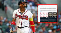 ¿Ronald Acuña Jr. superará su lesión?: este fue el llamativo análisis de médico especialista