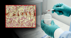 Conoce a MBK-01, la pastilla de heces fecales que reemplazará a los antibióticos contra infecciones graves