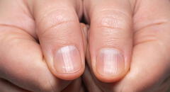 ¿Tus uñas tienen rayas? Descubre su significado y qué puedes hacer al respecto
