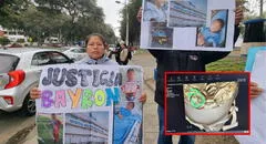 VMT: menor de 6 años va al dentista y termina con una aguja en la cabeza en hospital de Essalud