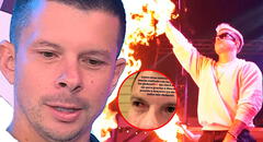 Mario Hart ALARMA al revelar que sufrió una FUERTE LESIÓN en el ojo: "Me clavé uno"