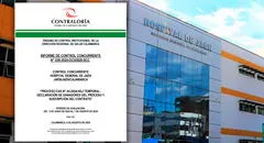 Contraloría advierte presuntas irregularidades en proceso CAS de hospital de Jaén: habían ganado personas que no cumplían requisitos