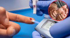 Diabetes en Perú: 1 de cada 5 pacientes es hospitalizado por pie diabético y el 17% tiene riesgo de amputación