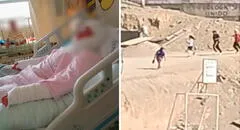 Profesor intenta prender antorcha por olimpiadas escolares en SJL y niña termina con graves quemaduras