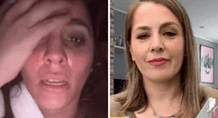 Yiddá Eslava sufre fuerte accidente en el rostro y preocupa a usuarios: "En pleno rodaje"