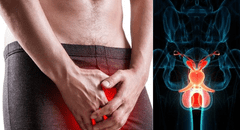 Casos de cáncer de pene aumentan en el mundo: estos son sus síntomas y así se puede prevenir, según expertos
