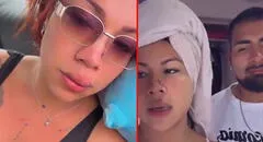 Dayanita niega que sus lesiones sean por una supuesta agresión de su novio: “Él tiene 12 puntos en su cabeza”