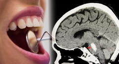 Científicos descubren que las bacterias que habitan en la boca podrían afectar a nuestro cerebro