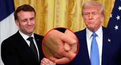 Donald Trump fue visto con hematomas en reunión con Macron en la Casa Blanca: ¿a qué se debe esta lesión?