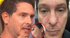 Cristian Rivero revela extraña reacción en su rostro que afecta su salud: “Los nervios existen”