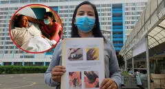 "Mi madre entró por una fractura y terminó sin un dedo": denuncian presunta negligencia médica en hospital Rebagliati