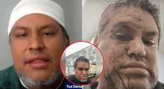 Ingeniero peruano denuncia agresión xenófoba en Chile y paramédicos se niegan a atenderlo a tiempo: "Me dijeron que no podían intervenir"