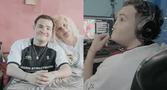 Superó leucemia, una infección que afecto su cara y 30 cirugías: la historia de superación de un adolescente que estuvo al borde de la muerte en Argentina