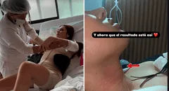 La ‘Uchulú’ impacta con radical cambio tras cirugía para reducirse ‘la manzana de Adán’ y costillas: “Pienso hacerme la voz en Colombia”
