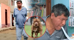 Peruano perdió los dos brazos y estuvo un mes en coma tras brutal ataque de 3 pitbulls: dueños no se hacen responsables