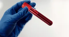 Científicos ponen a prueba sangre artificial en humanos compatible con cualquier grupo sanguíneo, según estudio en Japón