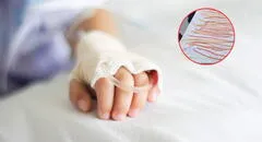 Extraen 142 lombrices intestinales a niño en México: lo operaron de emergencia tras dos días de dolores abdominales