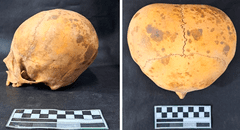 Arqueólogos resuelven el misterio de un cráneo con presunto aspecto ‘alienígena’ encontrado en Sudamérica