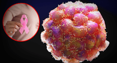 Científicos españoles identifican la proteína que ayuda a las células cancerosas a expandirse a otros órganos: "Son capaces de evadir el sistema inmune"
