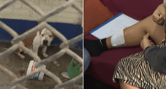Mujer queda gravemente herida tras ataque de perro pitbull sin bozal ni correa en Santa Anita: "Me tiré al piso para cubrirme la cara"