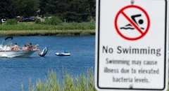 Menor muere tras contraer una ameba 'comecerebros' después de nadar en un lago de Estados Unidos