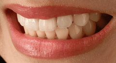 Científicos en Inglaterra descubren un nuevo tratamiento que permite regenerar naturalmente los dientes en adultos