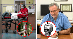 Adulto mayor sobrevivió dos días con una flecha clavada en la cabeza y llegó consciente al hospital en Italia