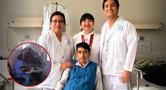 Llegó a Lima con los ojos y piel amarilla, y descubre que tiene cáncer: hospital salva su vida con la primera cirugía Whipple robótica del Perú