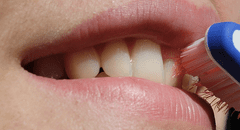 Científicos descubren una nueva solución para reparar los dientes dañados al usar un ingrediente peculiar