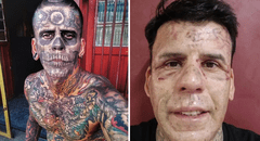 Su cuerpo estaba cubierto de tatuajes y ahora luce irreconocible tras someterse a una cirugía láser para quitárselos: conoce la historia de Leandro de Souza