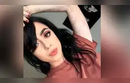 Instagram: Sufre de vitiligo, pero sus fotos son tendencia [FOTOS]