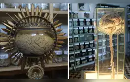 Conoce el museo más raro del Perú: está dentro de un hospital y la entrada solo cuesta S/5
