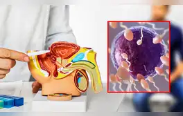 Eyacular al menos 21 veces al mes reduce el riesgo de padecer cáncer de próstata, según estudio de Harvard