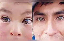 Peruano muestra los ojos ‘hazel’ de su familia y usuarios dicen: “Yo heredé miopía y astigmatismo”