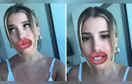 Yahaira Plasencia responde a quienes critican por su retoque estético y usuarios la apoyan: “Para que sigan hablando”