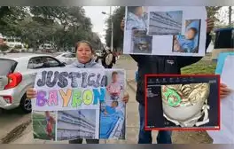 VMT: menor de 6 años va al dentista y termina con una aguja en la cabeza en hospital de Essalud