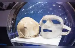 Médicos e ingenieros del INSN de San Borja trabajan en máscaras 3D para menores con quemaduras
