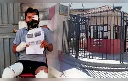 PJ ordena pago de medio millón de soles a favor de heladero que quedó desfigurado tras atropello en Arequipa