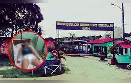 Alumno de escuela policial de Iquitos queda grave tras presunta agresión de sus compañeros: lo habrían golpeado hasta en la vista