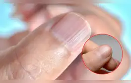 Esto es lo que dicen los expertos sobre tu estado de salud si tienes rayas en las uñas. Foto: composición LR/Clikisalud/Yahoo