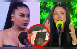Yolanda Medina ROMPE su silencio y revela la verdad sobre ecografía de Pamela Franco: "Es demasiado"