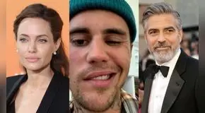Famosos que también sufrieron de parálisis facial como Justin Bieber