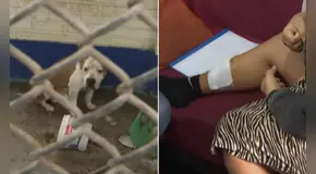 Mujer queda gravemente herida tras ataque de perro pitbull sin bozal ni correa en Santa Anita: "Me tiré al piso para cubrirme la cara"