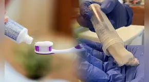 Los científicos quieren que usemos pastas de dentales hechas con cabellos porque pueden reparar los dientes