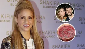 Shakira habría descubierto que Piqué la engañaba con Clara Chía ‘gracias a la mermelada’